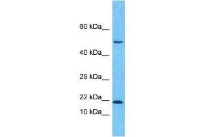 Host:  Rabbit  Target Name:  GA45B  Sample Type:  Fetal Lung lysates  Antibody Dilution:  3.