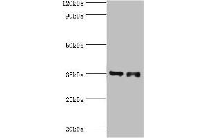 Western blot All lanes: Estrogen sulfotransferase antibody at 7 μg/mL Lane 1: Mouse lung tissue Lane 2: Mouse liver tissue Secondary Goat polyclonal to rabbit IgG at 1/10000 dilution Predicted band size: 35, 30 kDa Observed band size: 35 kDa (SULT1E1 anticorps  (AA 140-294))