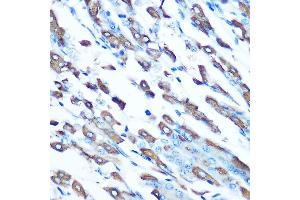 Immunohistochemistry of paraffin-embedded mouse stomach using DMT1 Rabbit pAb (ABIN6129471, ABIN6147839, ABIN6147840 and ABIN6214400) at dilution of 1:100 (40x lens).