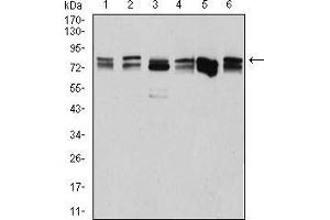 Western blot analysis using DDX3X mouse mAb against Hela (1), NIH3T3 (2), C6 (3), COS7 (4), A431 (5), and HEK293 (6) cell lysate.