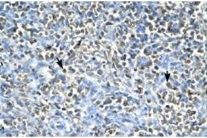 Immunohistochemical staining (Formalin-fixed paraffin-embedded sections) of human spleen with ASGR2 polyclonal antibody  at 4-8 ug/mL working concentration. (Asialoglycoprotein Receptor 2 anticorps  (N-Term))