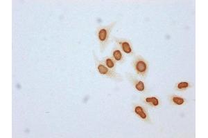 Immunocytochemistry analysis of ABIN7139176 diluted at 1:25 and staining in Hela cells (treated with 30mM sodium butyrate for 4h) performed on a Leica BondTM system.
