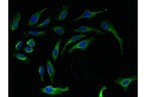 Immunofluorescent analysis of Hela cells using ABIN7142788 at dilution of 1:100 and Alexa Fluor 488-congugated AffiniPure Goat Anti-Rabbit IgG(H+L) (RPL27 anticorps  (AA 2-136))