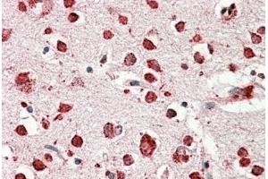 anti-Scavenger Receptor Class B, Member 2 (SCARB2) (Internal Region) antibody