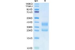 Biotinylated Human CD3E&CD3G on Tris-Bis PAGE under reduced condition. (CD3E & CD3G (AA 23-120) protein (His tag,Biotin))