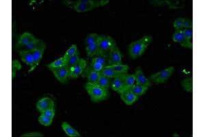 Immunofluorescent analysis of HepG2 cells using ABIN7156627 at dilution of 1:100 and Alexa Fluor 488-congugated AffiniPure Goat Anti-Rabbit IgG(H+L)