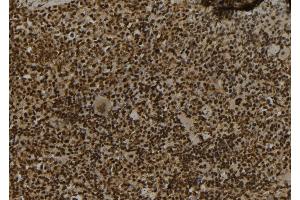 ABIN6273072 at 1/100 staining Mouse spleen tissue by IHC-P. (SECISBP2 anticorps  (Internal Region))