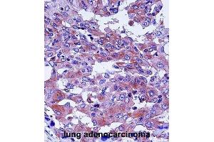 Immunohistochemistry (IHC) image for anti-Complement Decay-Accelerating Factor (CD55) antibody (ABIN2998248) (CD55 anticorps)