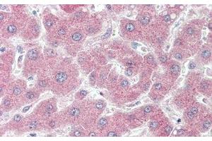 Detection of F5 in Human Liver Tissue using Polyclonal Antibody to Coagulation Factor V (F5)