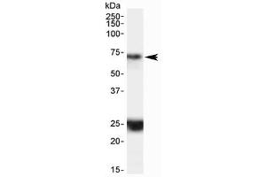 Western blot testing of human hippocampus lysate with HAP1 antibody at 0. (HAP1 anticorps)