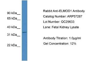 WB Suggested Anti-ELMOD1  Antibody Titration: 0. (ELMOD1 anticorps  (Middle Region))