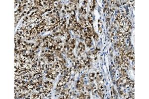 IHC analysis of PON1 using anti-PON1 antibody (ABIN7600530).