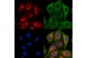 ABIN7094340 and ABIN7098387 staining Hela cells by IF/ICC. (LETM2 anticorps  (C-Term))