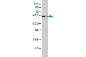 STEAP1 monoclonal antibody (M01), clone 4F6-1F3 Western Blot analysis of STEAP1 expression in A-431 . (STEAP1 anticorps  (AA 1-339))