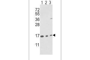 Western blot analysis of IA Antibody (N-term) (ABIN389487 and ABIN2839546) in T47D cell line(lane 1) and mouse brain(lane 2),bladder(lane 3) tissue lysates (35 μg/lane). (PPIA anticorps  (N-Term))