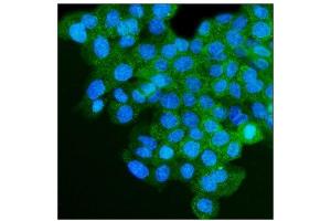 IF analysis of IGF2R using anti-IGF2R antibody (ABIN7601705).