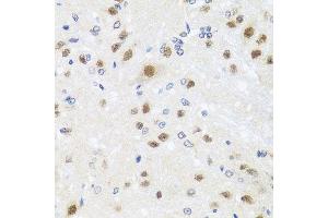 Immunohistochemistry of paraffin-embedded rat brain using CETN3 antibody.