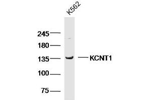 K562 cell lysates probed with KCNT1 Polyclonal Antibody, unconjugated  at 1:300 overnight at 4°C followed by a conjugated secondary antibody for 60 minutes at 37°C. (KCNT1 anticorps  (AA 101-200))