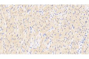 Detection of RANk in Human Cardiac Muscle Tissue using Polyclonal Antibody to Receptor Activator Of Nuclear Factor Kappa B (RANk)