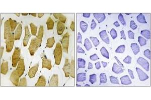 Immunohistochemistry analysis of paraffin-embedded human skeletal muscle, using Arachidonate 5 Lipoxygenase (Phospho-Ser271) Antibody. (ALOX5 anticorps  (pSer272))