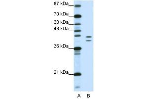 HNRPD antibody used at 1. (HNRNPD/AUF1 anticorps)