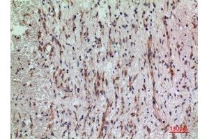 Immunohistochemistry (IHC) analysis of paraffin-embedded Human Brain, antibody was diluted at 1:100.