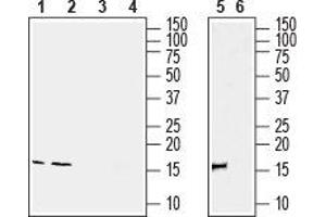 Western blot analysis of rat spleen (lanes 1 and 3), rat testis (lanes 2 and 4) and mouse spleen (lanes 5 and 6) lysates:1, 2, 5. (Ionized Calcium-binding Adapter Molecule 1 (IBA1) Peptide)