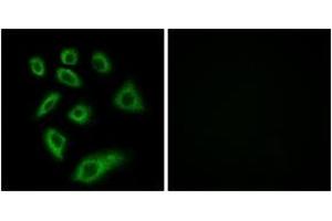 Immunofluorescence analysis of HuvEc cells, using Cytochrome P450 2W1 Antibody. (CYP2W1 anticorps  (AA 311-360))