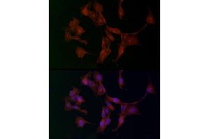 Immunofluorescence analysis of U-87 MG cells using  Rabbit pAb (ABIN3016805, ABIN3016806, ABIN3016807 and ABIN6219845) at dilution of 1:100. (ADAMTS5 anticorps  (AA 731-930))
