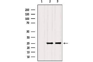 Western blot analysis of extracts from various samples, using RAB3A Antibody. (RAB3A anticorps  (N-Term))
