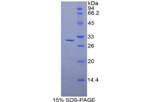 SDS-PAGE analysis of Rat Histone Deacetylase 6 Protein. (HDAC6 Protéine)