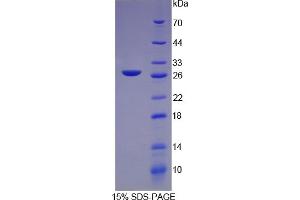 SDS-PAGE of Protein Standard from the Kit (Highly purified E. (CRP Kit CLIA)