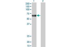 Western Blot analysis of PRKAA2 expression in transfected 293T cell line by PRKAA2 monoclonal antibody (M02), clone 1G8. (PRKAA2 anticorps  (AA 453-552))