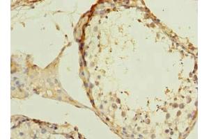 Immunohistochemistry of paraffin-embedded human testis tissue using ABIN7175982 at dilution of 1:100 (ZBTB43 anticorps  (AA 165-467))