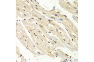Immunohistochemistry of paraffin-embedded mouse heart using PSME1 antibody.