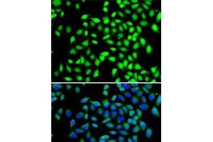 Immunofluorescence analysis of A-549 cells using SGTA Polyclonal Antibody (SGTA anticorps)