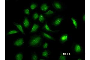 Immunofluorescence of monoclonal antibody to GART on HeLa cell. (GART anticorps  (AA 1-433))
