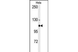 Western blot analysis of anti-ACTN4 Antibody (N-term) (ABIN392218 and ABIN2841914) in Hela cell line lysates (35 μg/lane). (alpha Actinin 4 anticorps  (N-Term))