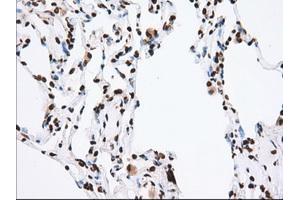 Image no. 3 for anti-Transforming, Acidic Coiled-Coil Containing Protein 3 (TACC3) antibody (ABIN1498096)