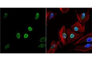 Immunofluorescence (IF) image for anti-Histone Deacetylase 1 (HDAC1) antibody (ABIN2854776)