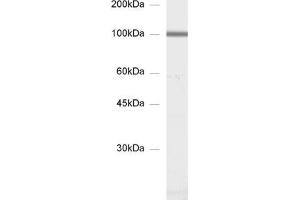 dilution: 1 : 1000, sample: synaptic membrane fraction of rat brain (LP1) (GluA 3 (AA 860-871) anticorps)