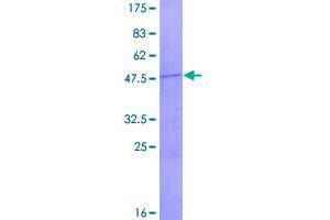 Image no. 1 for Ribosomal Protein L13a (RPL13A) (AA 1-203) protein (GST tag) (ABIN1318548)