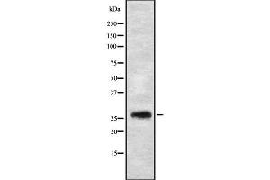 Western blot analysis FGFBP3 using HT29 whole cell lysates (FGFBP3 anticorps  (C-Term))