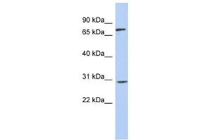 Western Blot showing ZNF131 antibody used at a concentration of 1-2 ug/ml to detect its target protein. (ZNF131 anticorps  (Middle Region))