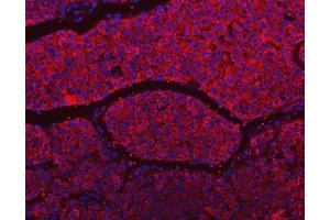 IF analysis of SLU7 using anti-SLU7 antibody (ABIN7601697). (SLU7 anticorps  (AA 42-474))
