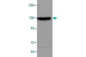 SRGAP2 polyclonal antibody  (0. (SRGAP2 anticorps  (Internal Region))