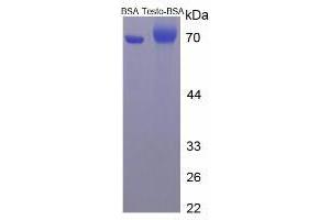 Image no. 2 for Testosterone protein (BSA) (ABIN1880112)