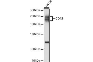 Western blot analysis of extracts of Jurkat cells, using CD45 antibody (ABIN6130077, ABIN6146454, ABIN6146456 and ABIN6213826) at 1:1000 dilution.