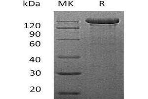 Western Blotting (WB) image for Sema Domain, Immunoglobulin Domain (Ig), Transmembrane Domain (TM) and Short Cytoplasmic Domain, (Semaphorin) 4C (SEMA4C) protein (Fc Tag) (ABIN7320640)