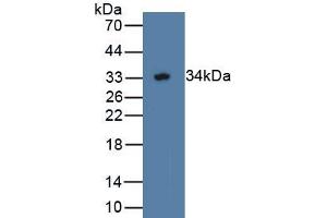 Detection of Recombinant WWP2, Human using Polyclonal Antibody to WW Domain Containing E3 Ubiquitin Protein Ligase 2 (WWP2) (WWP2 anticorps  (AA 601-870))